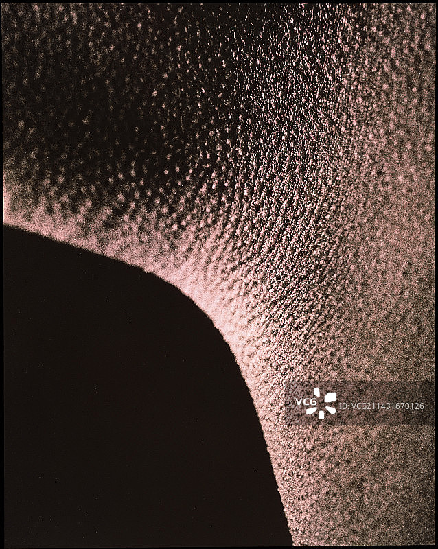 女性腋下的鸡皮疙瘩图片素材