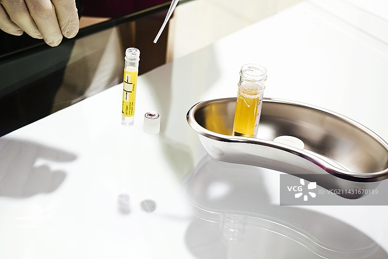 尿液衣原体测试图片素材