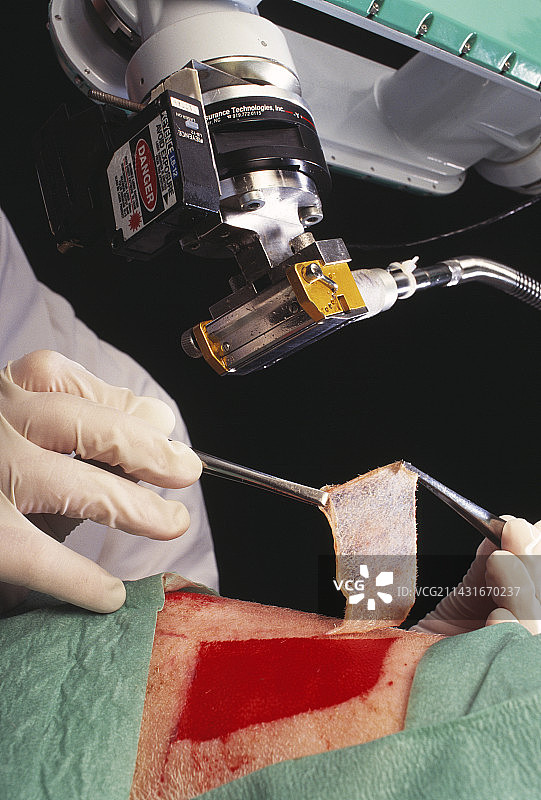 皮肤采集机器人图片素材