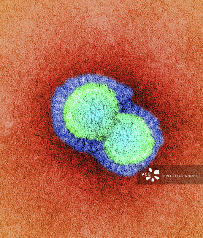 H5N1禽流感病毒颗粒（透射电镜）图片素材