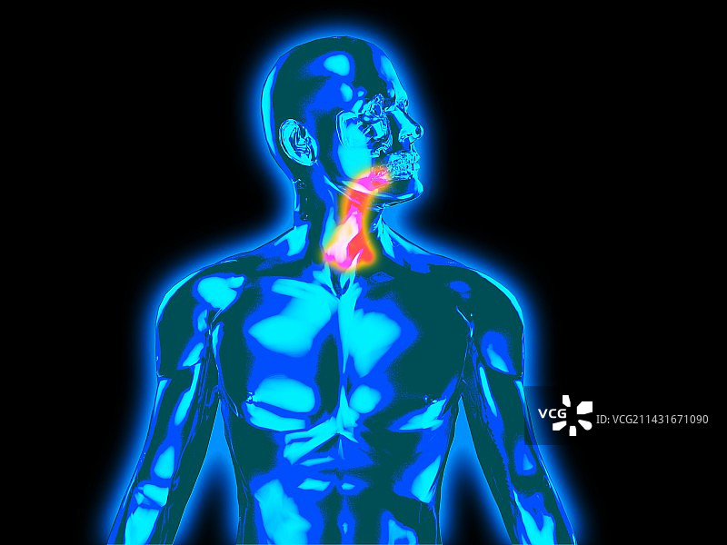 嗓子疼图片素材