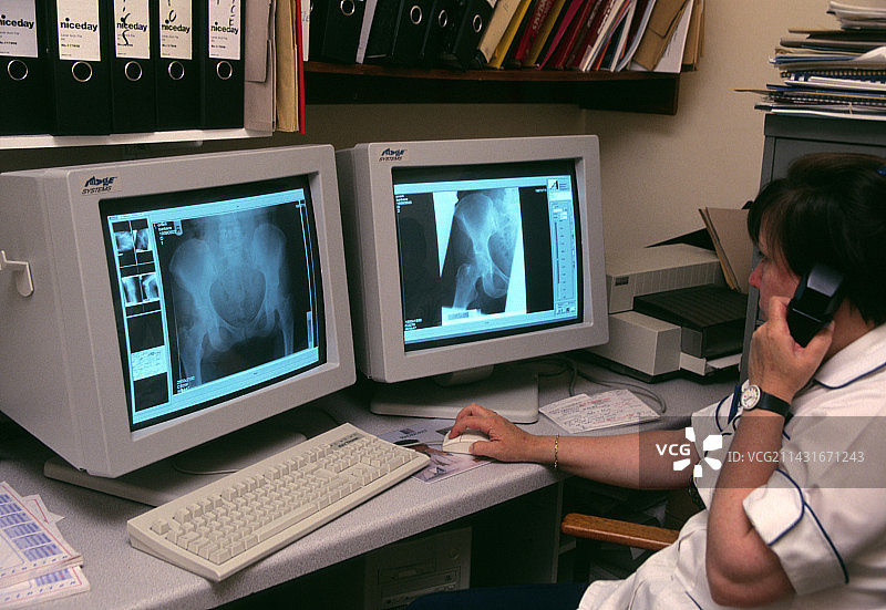 X光诊断图片素材