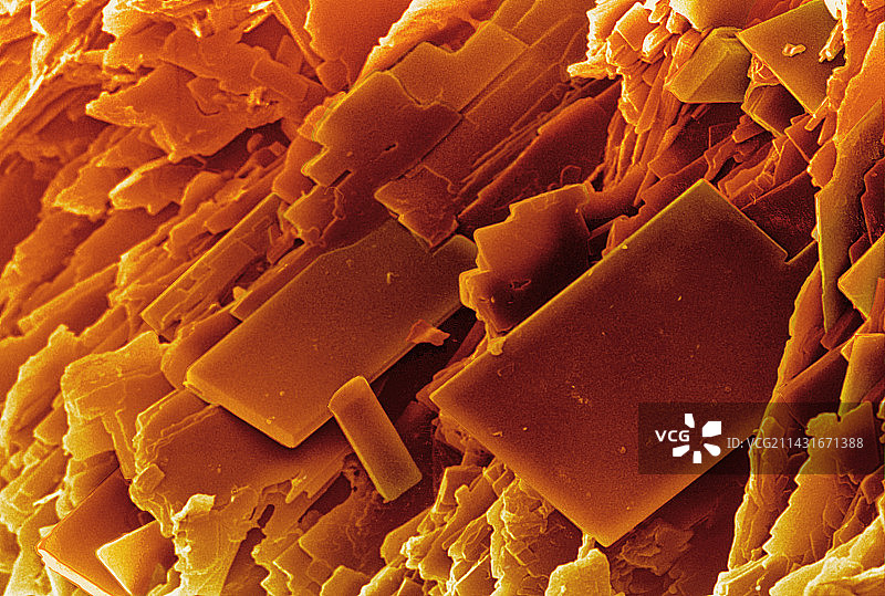 胆结石的彩色扫描电镜图像图片素材