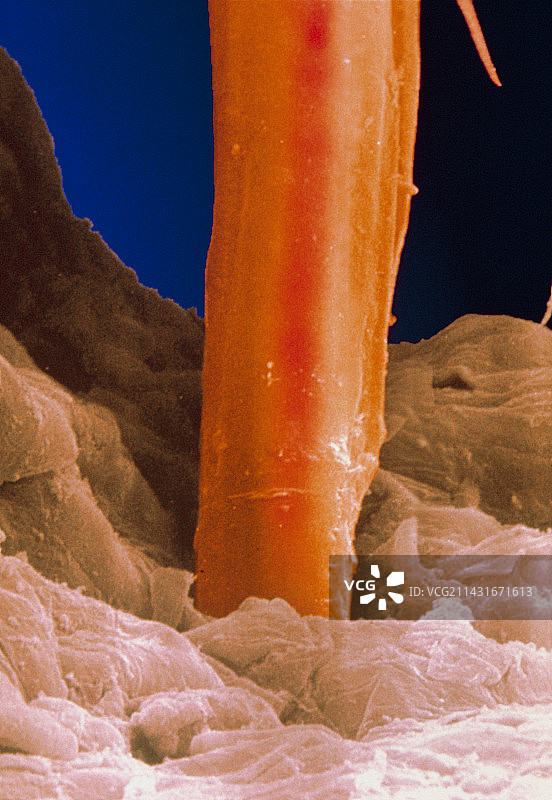 猫蚤口针刺入皮肤的电子显微照片图片素材