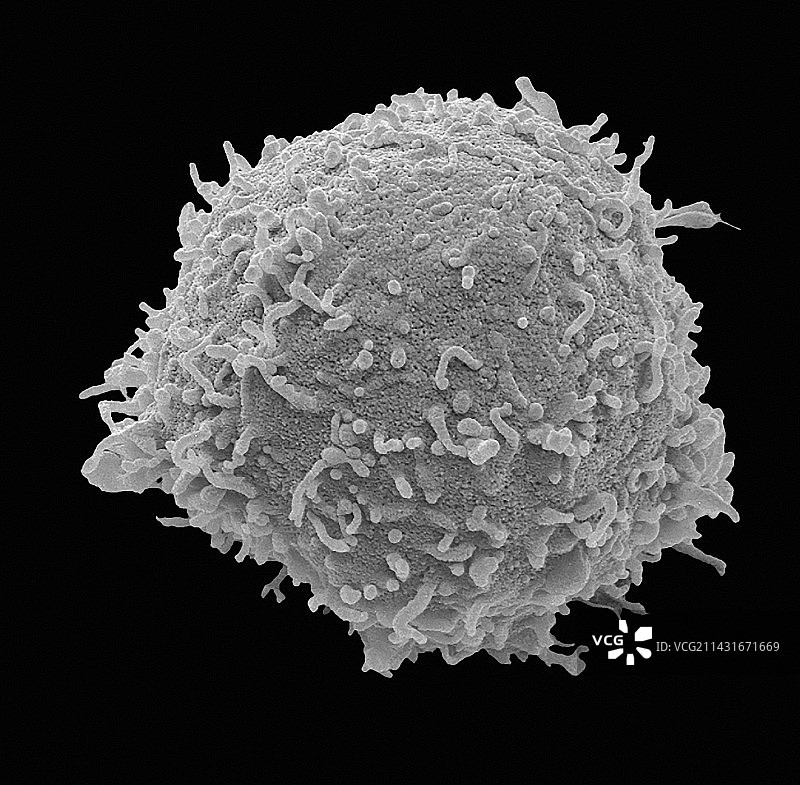 T淋巴细胞扫描电镜图图片素材