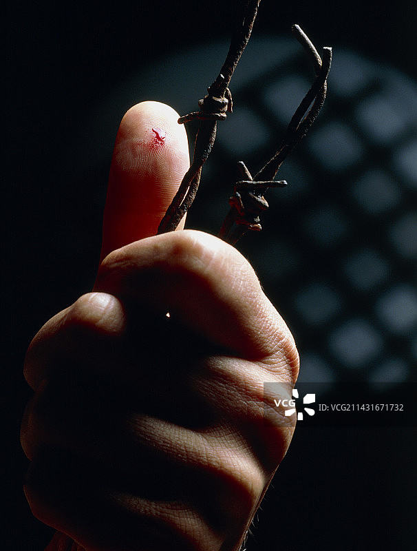 手指被带刺铁丝网划伤：破伤风的原因图片素材