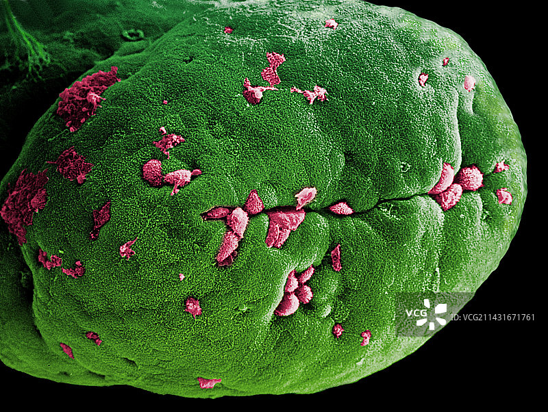 小肠绒毛的彩色扫描电镜图图片素材