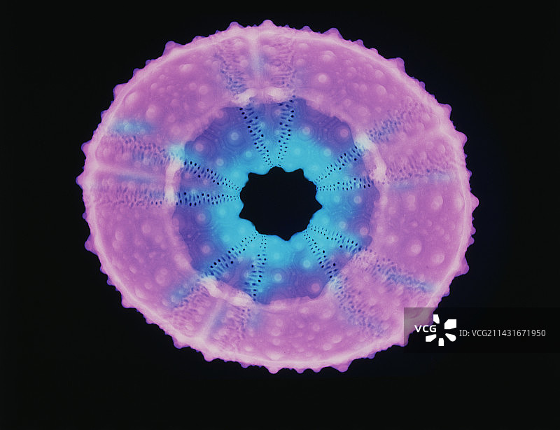 海胆壳的X射线照片图片素材