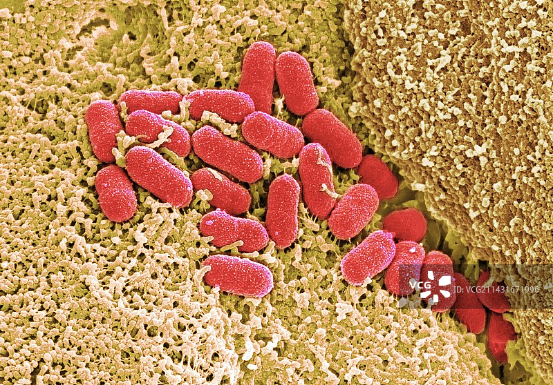 人结肠组织上的肠出血性大肠杆菌（扫描电镜图）图片素材