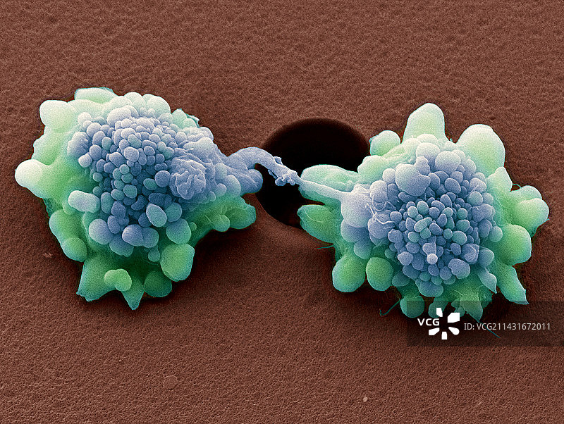 HeLa细胞分裂（扫描电镜）图片素材