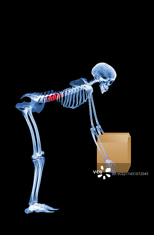 骨骼抬起一个不正确的盒子图片素材