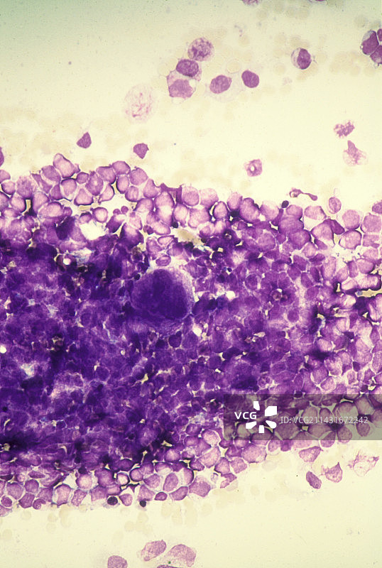 骨髓切片的光学显微照片图片素材