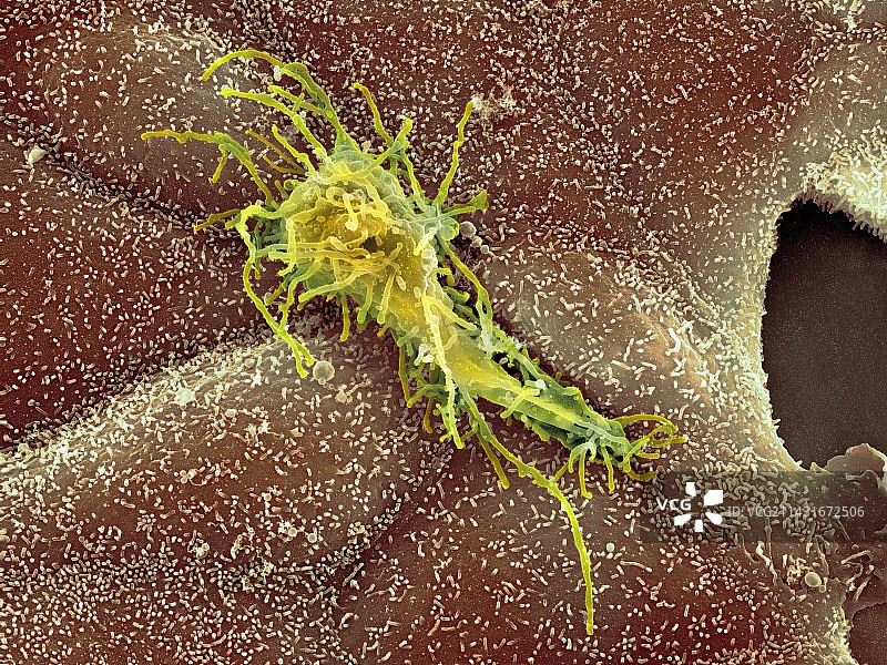 癌细胞扫描电镜图图片素材