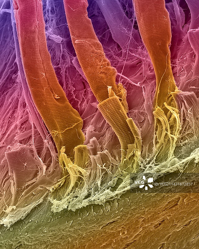 附着在骨表面的肌腱，扫描电镜图图片素材