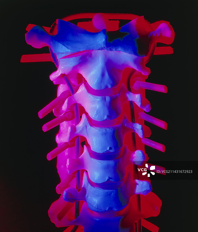 颈椎模型图片素材