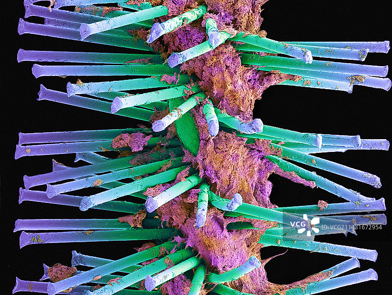 用过的齿间刷，扫描电镜图片素材