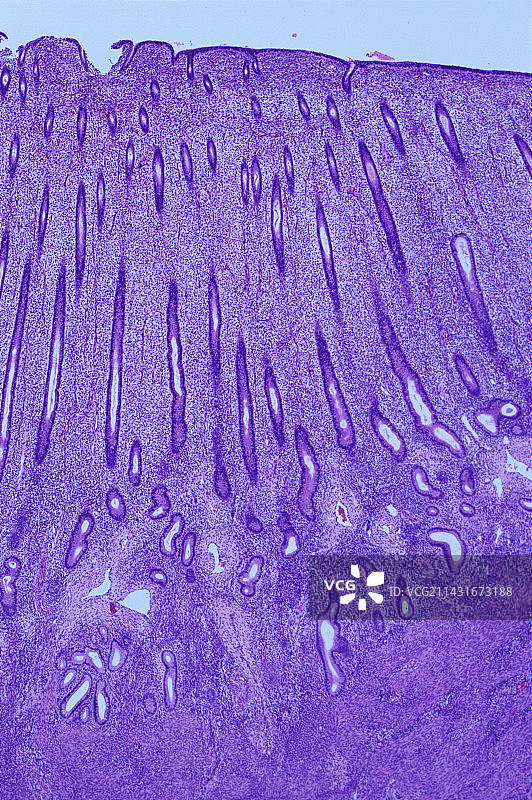 子宫内膜图片素材