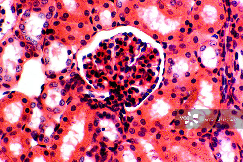 肾小球显微照片图片素材