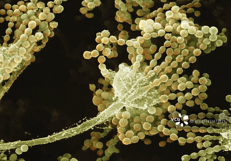 曲霉菌，扫描电镜图图片素材