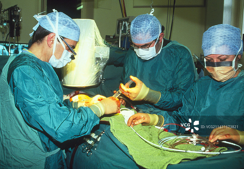 心脏瓣膜手术图片素材