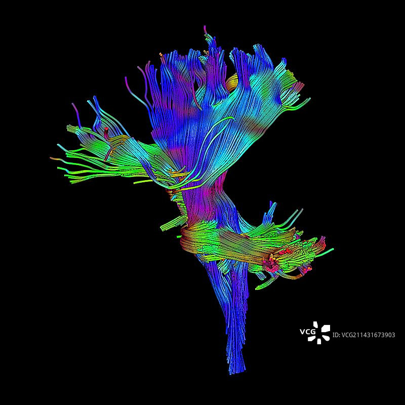 白质纤维DTI扫描图片素材
