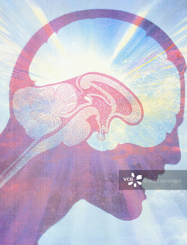 头痛男子面部上的大脑艺术作品图片素材
