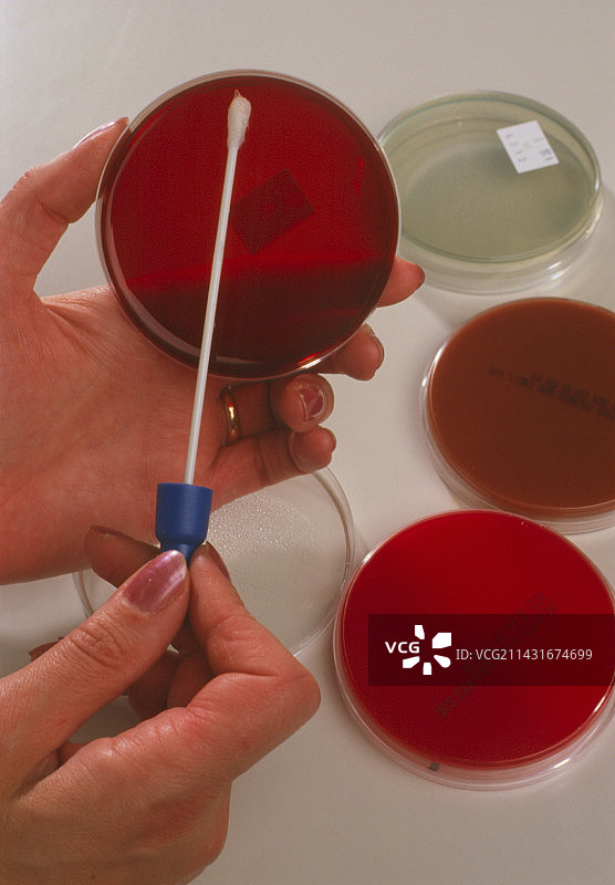 手持阴道拭子在培养皿的凝胶上擦拭图片素材