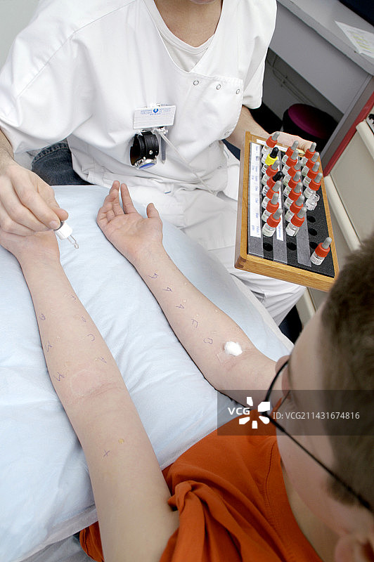 过敏测试图片素材