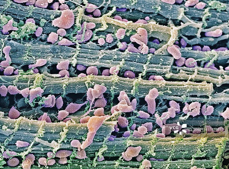 心肌扫描电镜图图片素材