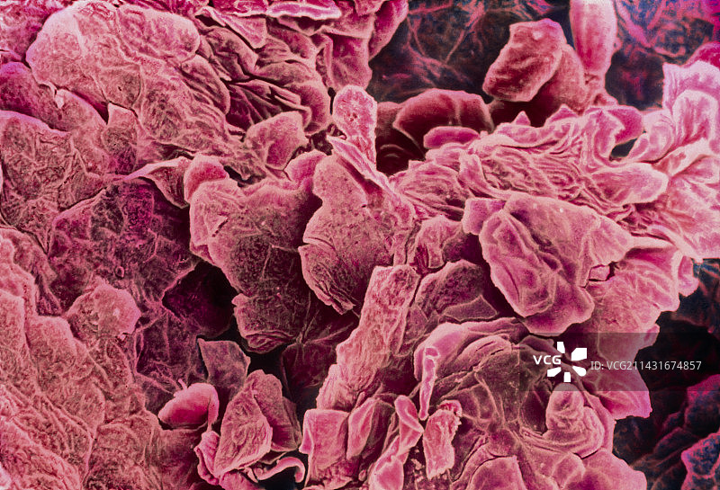 舌头表面上皮细胞的彩色扫描电镜图图片素材