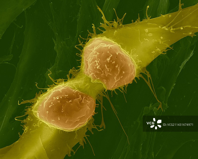 肌肉成肌细胞分裂，扫描电镜图片素材