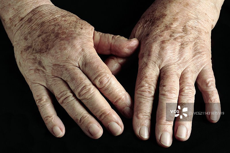 年长女性的手图片素材