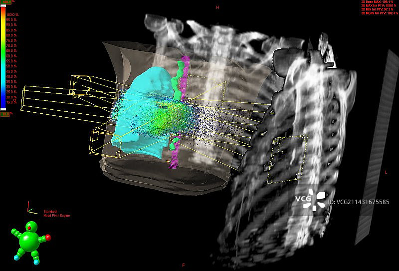 癌症治疗计划截图图片素材