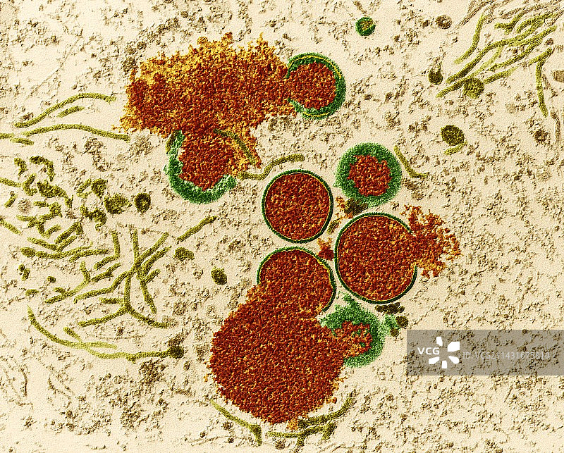 牛痘病毒颗粒，TEM图片素材