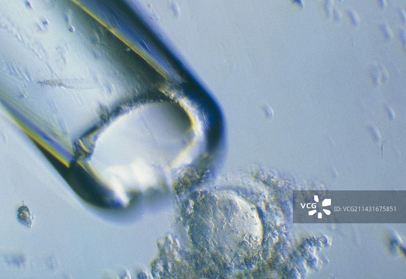 体外受精准备期间的人卵细胞光学显微镜照片图片素材