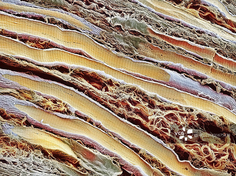 骨骼肌纤维，扫描电子显微镜图片素材