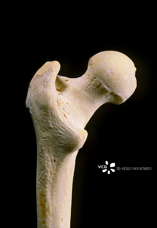 人类股骨头部（大腿骨）图片素材