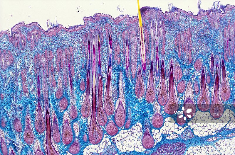 毛囊头皮显微照片图片素材