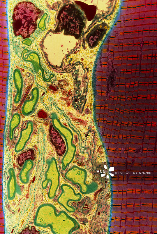 彩色骨骼肌和神经纤维透射电镜图图片素材