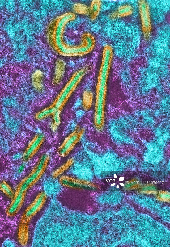 埃博拉病毒TEM图片素材