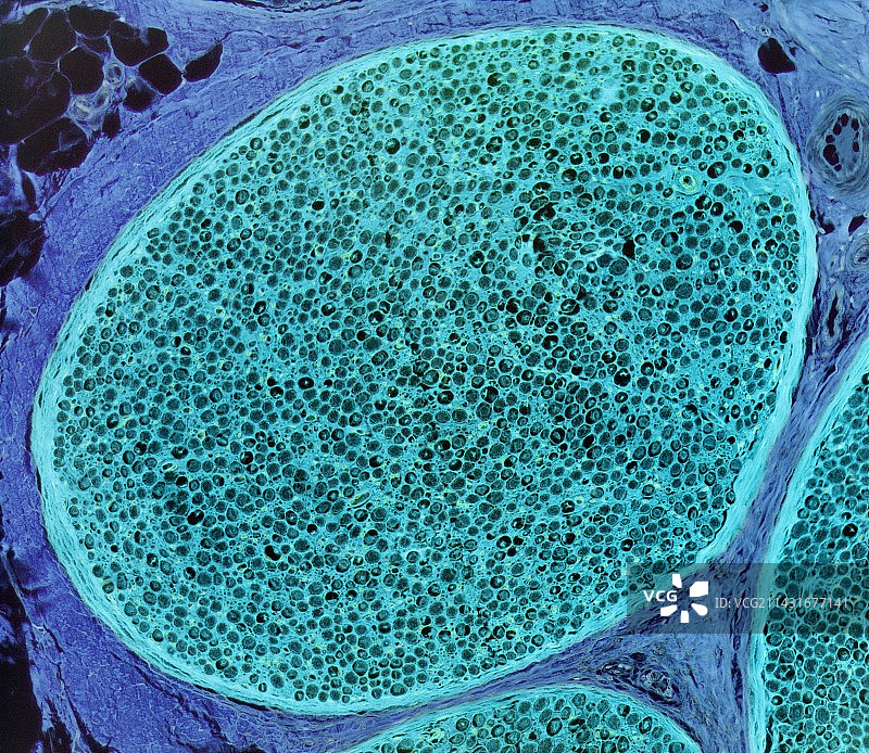 神经，LM图片素材
