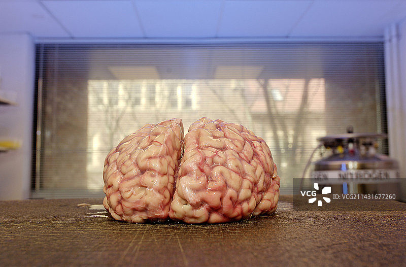 人类的大脑图片素材