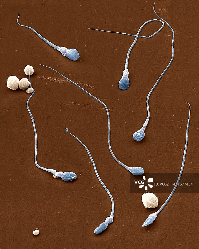 精子细胞，扫描电子显微镜图片素材