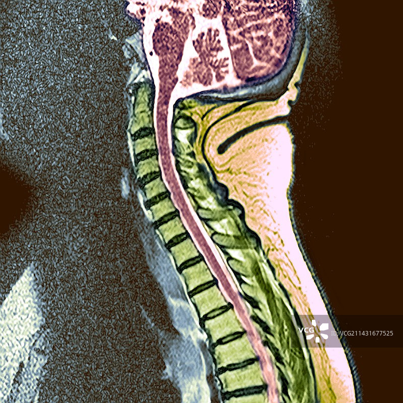 健康的脊椎图片素材