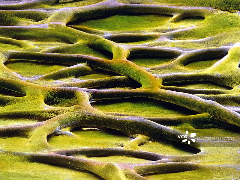 胆囊的扫描电镜图图片素材