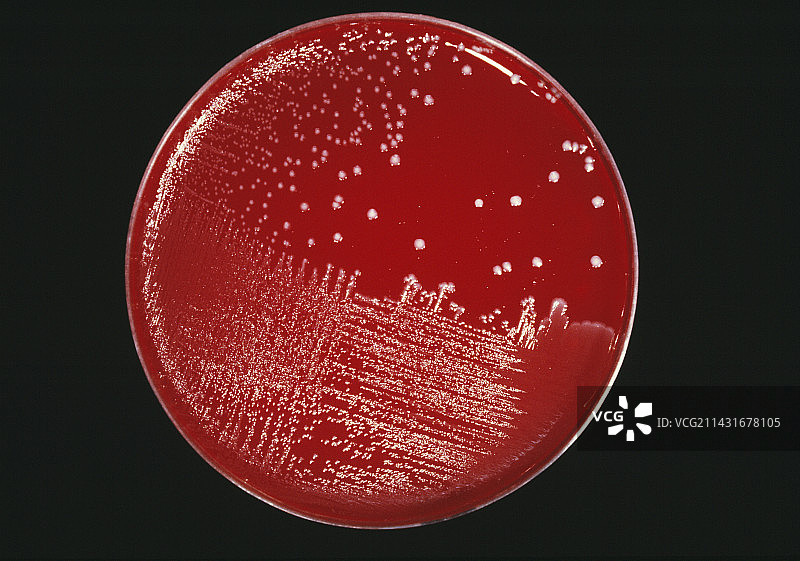 培养的败血症细菌图片素材