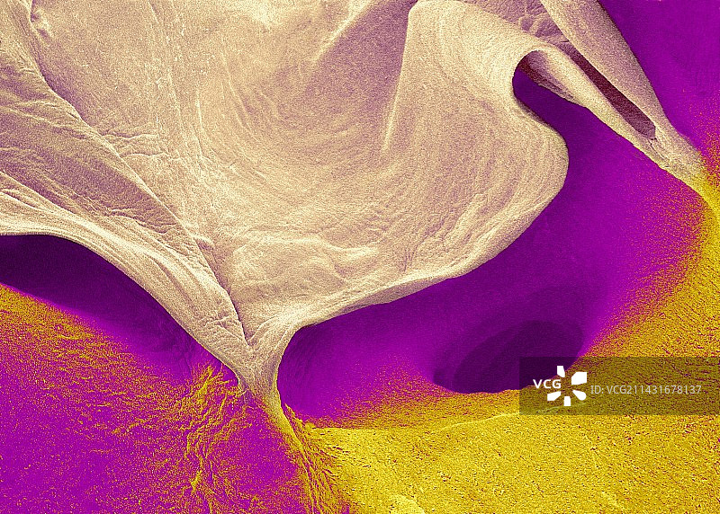 主动脉瓣，扫描电镜图片素材