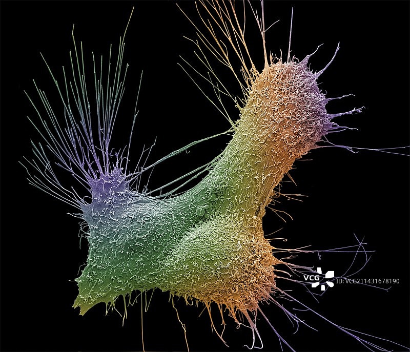 前列腺癌细胞扫描电镜图图片素材