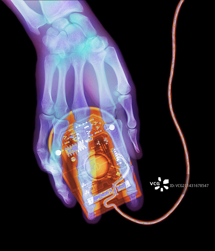 电脑鼠标和人手的彩色X光照片图片素材