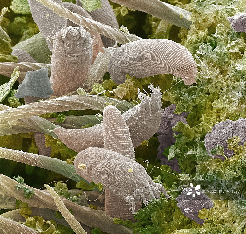 瘿螨，扫描电镜图片素材